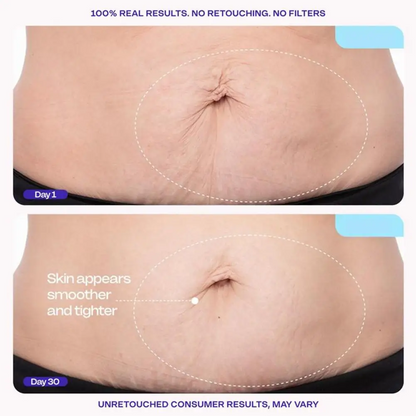 Tighten & Smooth Fast-Absorbing Moisturizing Belly Cream